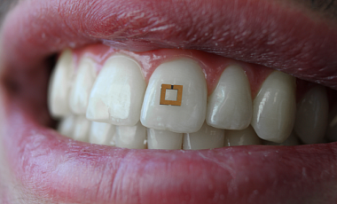 В США ученые изобрели мини-датчик на зуб для анализа состава еды